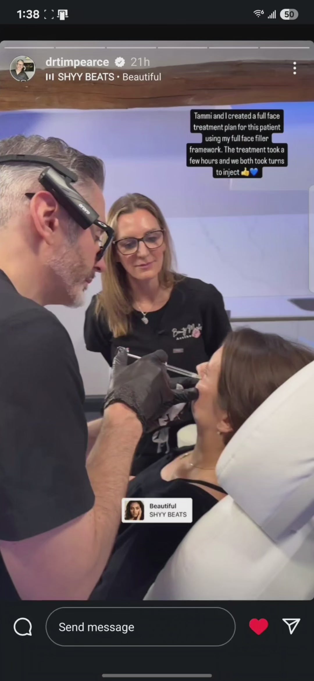 Load video: Control Ring syringe accessory for Juvederm dermal filler – supports one-hand aspiration